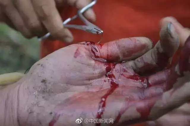 深度打击,当现实的伤口被剧情温柔剖开 深度打击,当现实的伤口被剧情温柔剖开